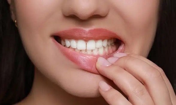 Harnessing Aromatherapy for Enhanced Dental Implant Recovery